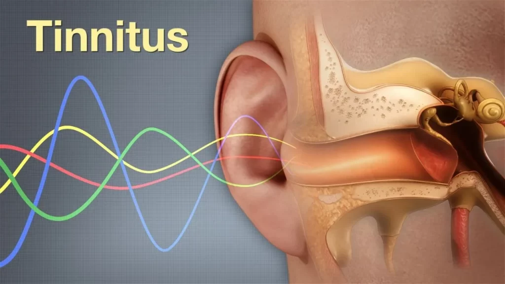 Tinnitus symptoms and ears crackling